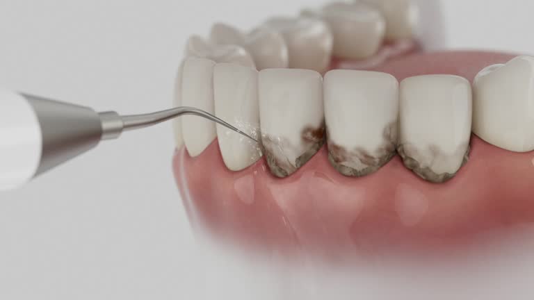 Reliable Dental Implants contractor in Upper Brookville, NY by Smile Center Dentistry